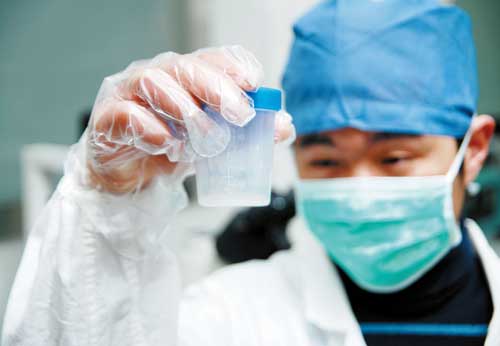 医生检查精子 医生检查精子