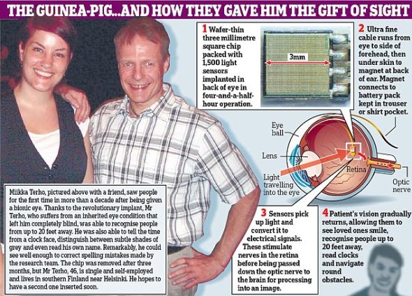 麦克拉伦计划2011年初开始在英国测试这种仿生眼 麦克拉伦计划2011年初开始在英国测试这种仿生眼