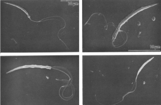 精子波动膜 精子波动膜