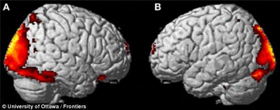 科学家发现,超越肉体经验涉及到“视觉皮层的强烈钝化”。A显示的是右侧视觉皮层,B显示的是左侧视觉皮层 科学家发现,超越肉体经验涉及到“视觉皮层的强烈钝化”。A显示的是右侧视觉皮层,B显示的是左侧视觉皮层