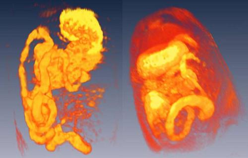 科学家通过3D模型显示人体内脏器官