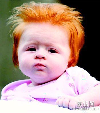 论坛:英国一女婴<em>天生</em>红发酷似猫王(图)--科技--