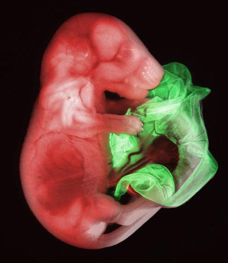2007年最佳显微照片转基因老鼠胚胎居首(图)