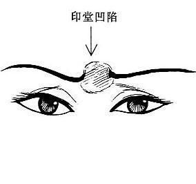 女人面相之印堂凹陷(图片来源于作者博客) 女人面相之印堂凹陷(图片来源于作者博客)