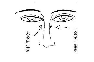 脸上生疮易导致霉运(图片来源于作者博客) 脸上生疮易导致霉运(图片来源于作者博客)