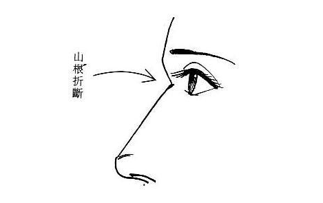 女性山根折断夫缘不佳(图片来源于作者博客) 女性山根折断夫缘不佳(图片来源于作者博客)