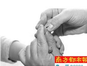 针刺放血是中医临床帮助退热的外治疗法之一,调血理气使脏腑气血调和,恢复正常功能。 针刺放血是中医临床帮助退热的外治疗法之一,调血理气使脏腑气血调和,恢复正常功能。