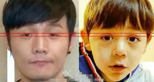 双眼皮PK组图中的一张 双眼皮PK组图中的一张