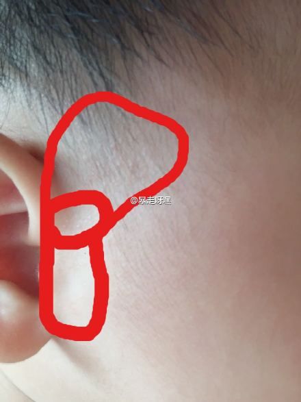 专家问答:育儿专家鲍秀兰答宝宝吃喝拉撒那些