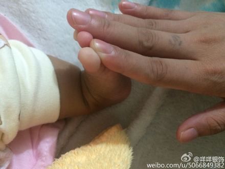 专家问答:育儿专家鲍秀兰答宝宝小状况如何应对(四十一)