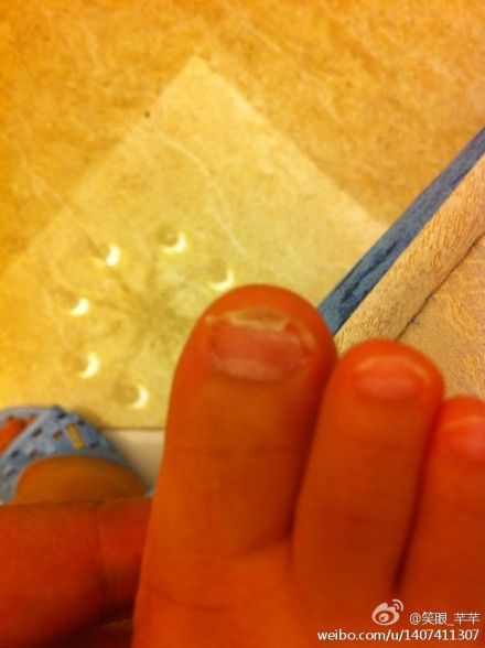 专家问答:儿科教授王玉玮答儿童心身性疾病及