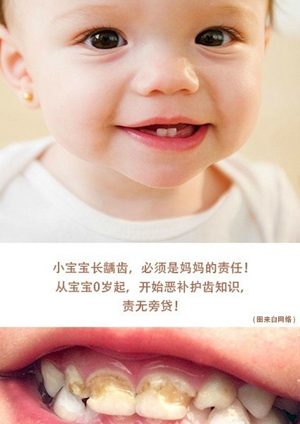 宝宝长龋齿,妈妈别忽视