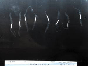 冬虫夏草里嚼出保险丝_滚动新闻