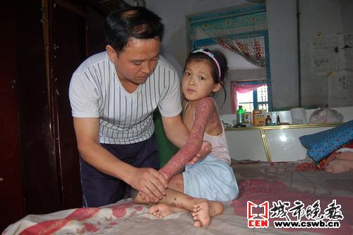 毛孩植皮归来 着急要上学(图文)