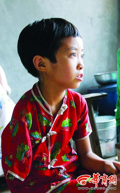 独掌女孩找到烫伤属意外(图)