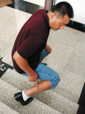 流浪狗咬人 谁该负责?