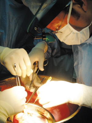 心脏移植 肿瘤摘除一次手术 双病除根(图)