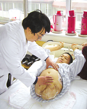 幸因车祸高位截肢