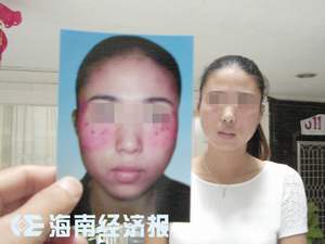 一女子擦珍珠粉脸部溃烂 商家称皮肤敏感所致