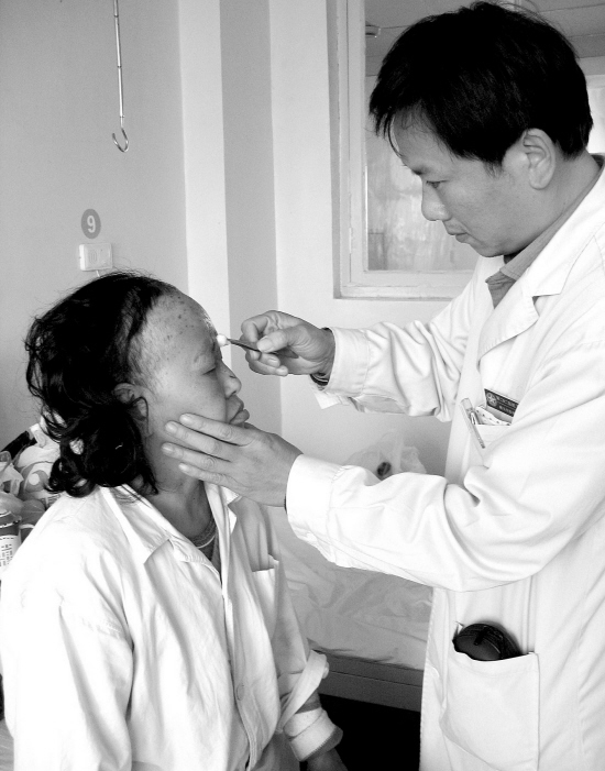 在去除痣的问题上