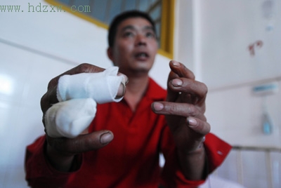 没取得签字就截掉手指