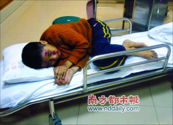 无牌面包车撞小孩后逃逸