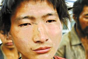 ͼ�ģ���������ȵĲ���ש����