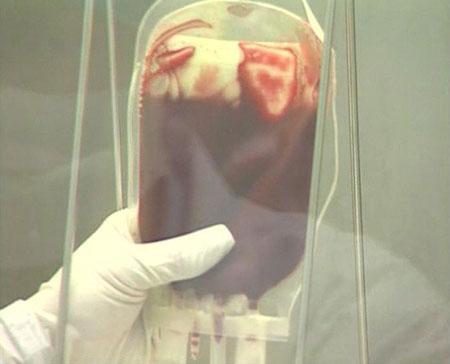 骨髓捐献:大陆爱心送台湾(组图)