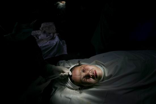 图文:<em>网络红人</em>蔷薇老妈接受整容手术_新闻中心