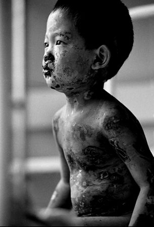 图文:丢丢的故事