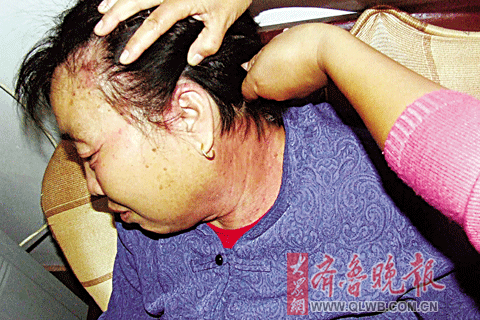 头发染黑皮肤却染红