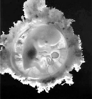 英国拟批准人兽杂交计划 反对者:会颠覆人与