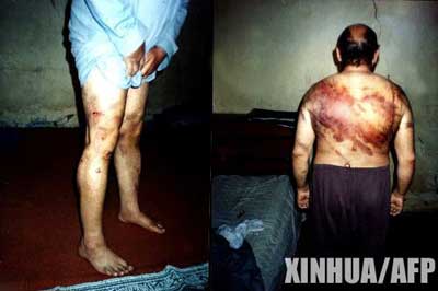 美中情局十大酷刑揭秘 堪称人权史<em>耻辱</em>(图)_新