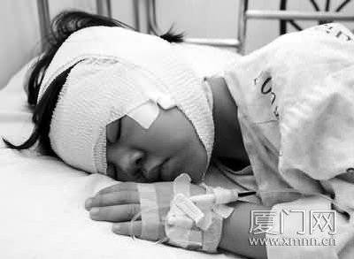 取大腿皮肤,再造外耳道