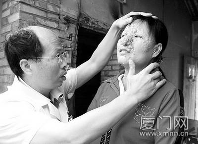 这张疙瘩脸 我不想要了