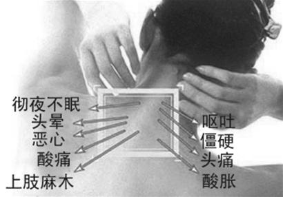 专药专治颈椎病 年老不怕脖子瘫