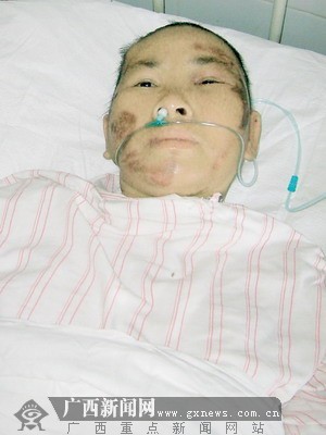 流浪女被车撞后发现怀有身孕(<em>图</em>)_新闻中心_新