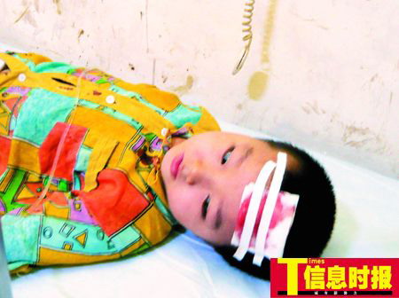 铁器高空坠落砸中6岁儿童头部(图)