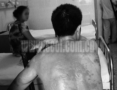 女子用热油泼丈夫两人曾发生争吵(图)