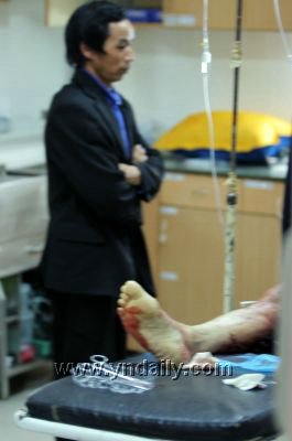 儿子夺刀失手挑断亲爹股动脉