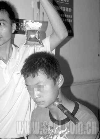 鱼竿根部钢筋刺穿少年喉部(图) -- 通吃岛股票证