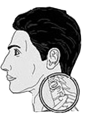 坐黄鱼车是怎么坐到颈椎错位的?