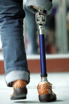 好心人帮她装上一条假腿 “独脚农妇”告别用了30年的拐杖_新闻中心_新浪网