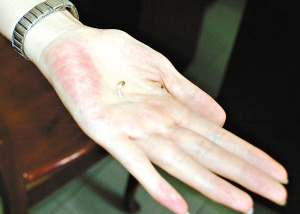 神秘人持毒蛇牙闹市刺人威胁勒索(图)