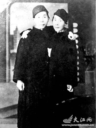 兄弟连体70年各自娶妻生子一人饮酒两人醉(图)