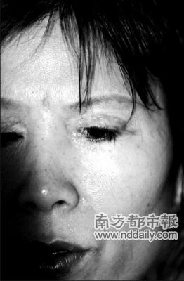 女子双眼皮手术失败致3年无法闭眼(图)