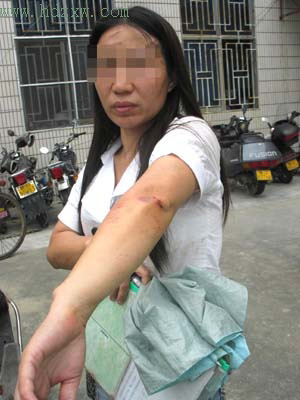 山解手时遭遇抢匪