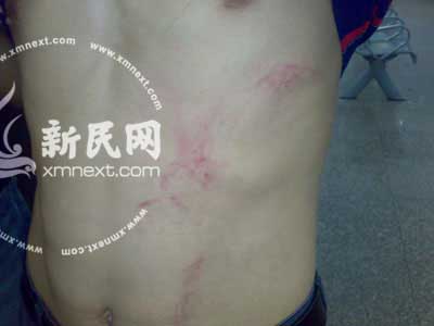 ̯����˿�Ź�򲢱����¹�(��ͼ)