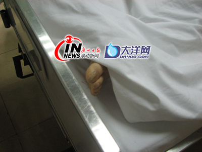 死者尸体仍停放在珠江医院急诊室中 记者史勇,徐佳丽 摄