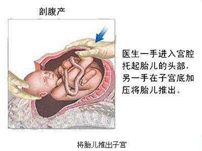 主刀皇后_主刀医生收入